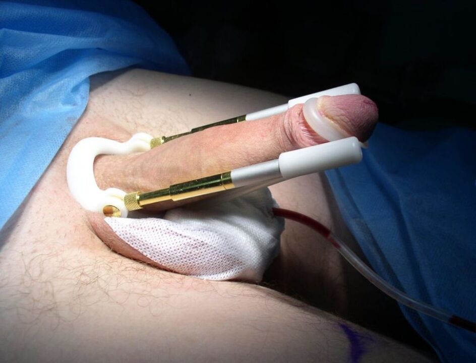 wearing a stretching device after surgery