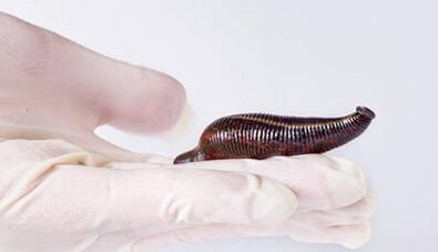 Leech cream to increase membership
